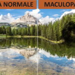 oculista corato maculopatia loiodice centro oculistico